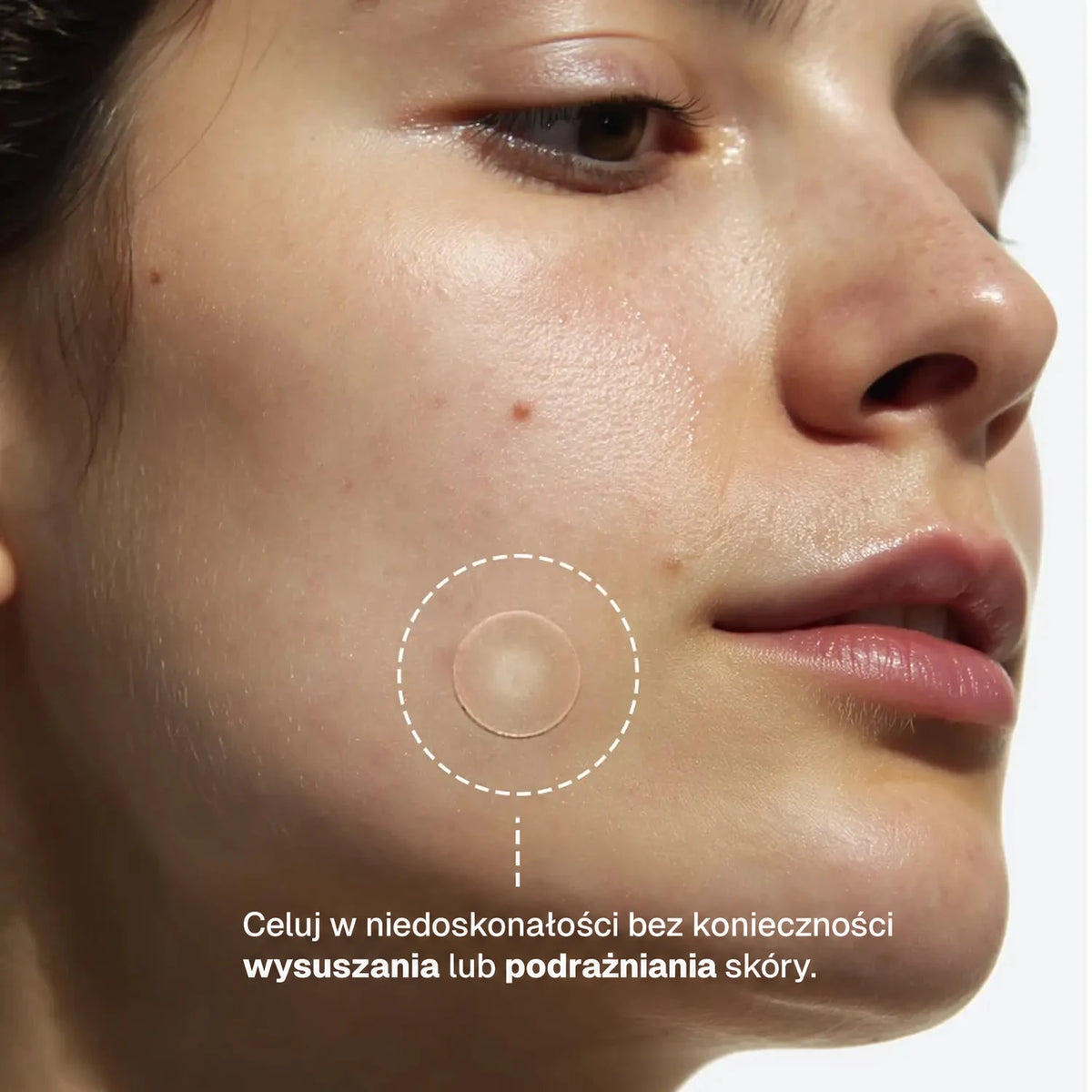 clear-dots-acne-patches gallery 3 (pl)