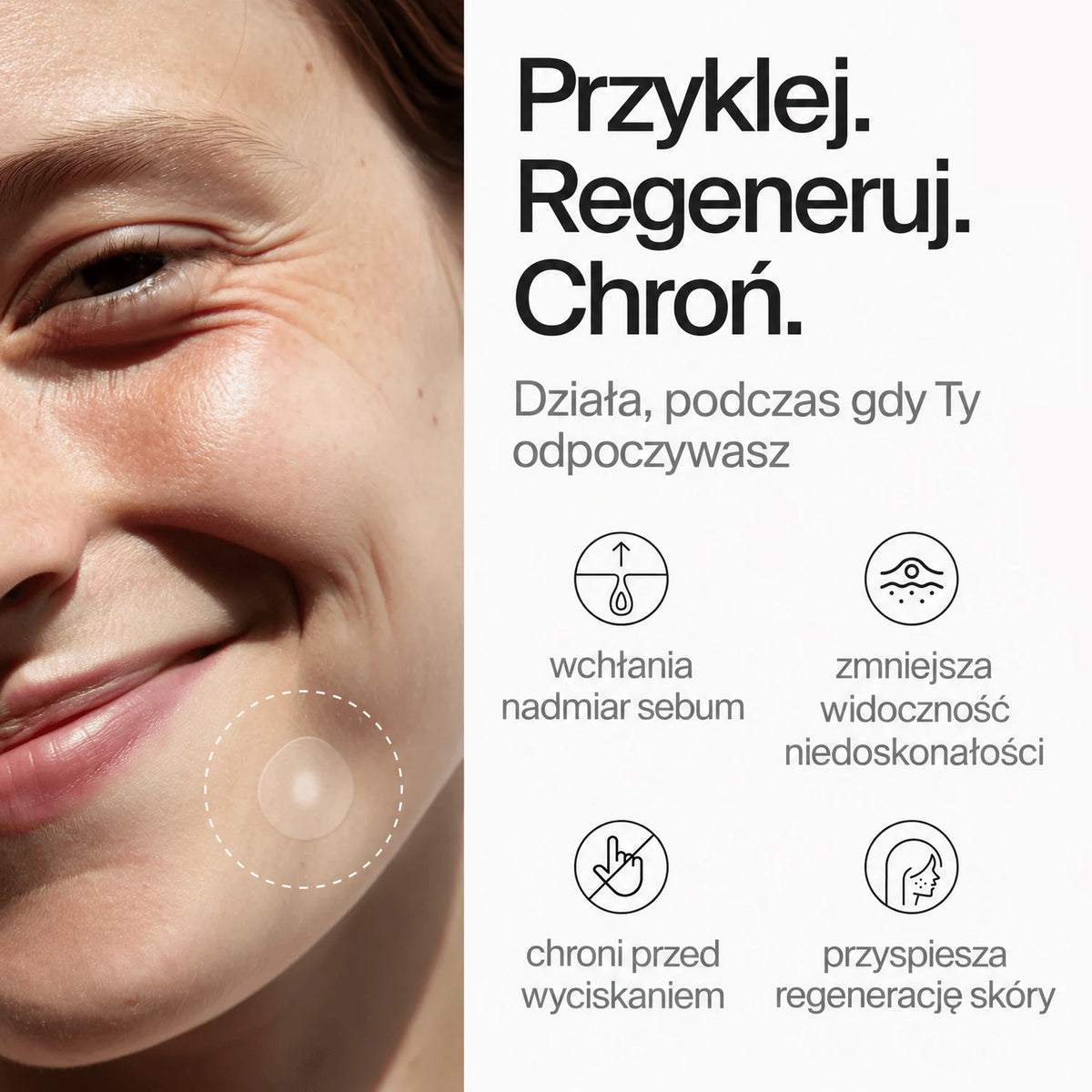 clear-dots-acne-patches gallery 6 (pl)
