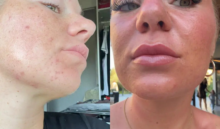 Bebette — After 8 weeks