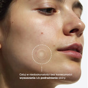 clear-dots-acne-patches gallery 3 (pl)