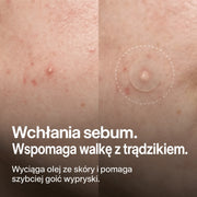 clear-dots-acne-patches gallery 2 (pl)