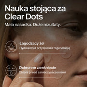 clear-dots-acne-patches gallery 5 (pl)