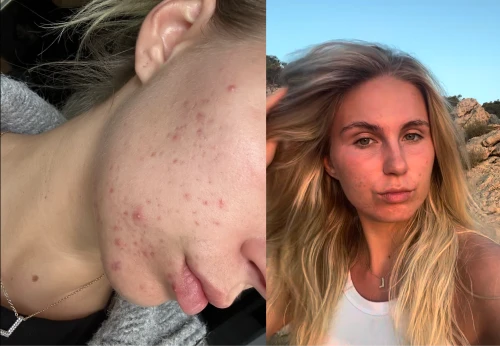 Before / After