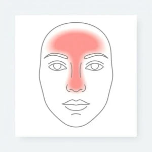 Nose / T-zone
